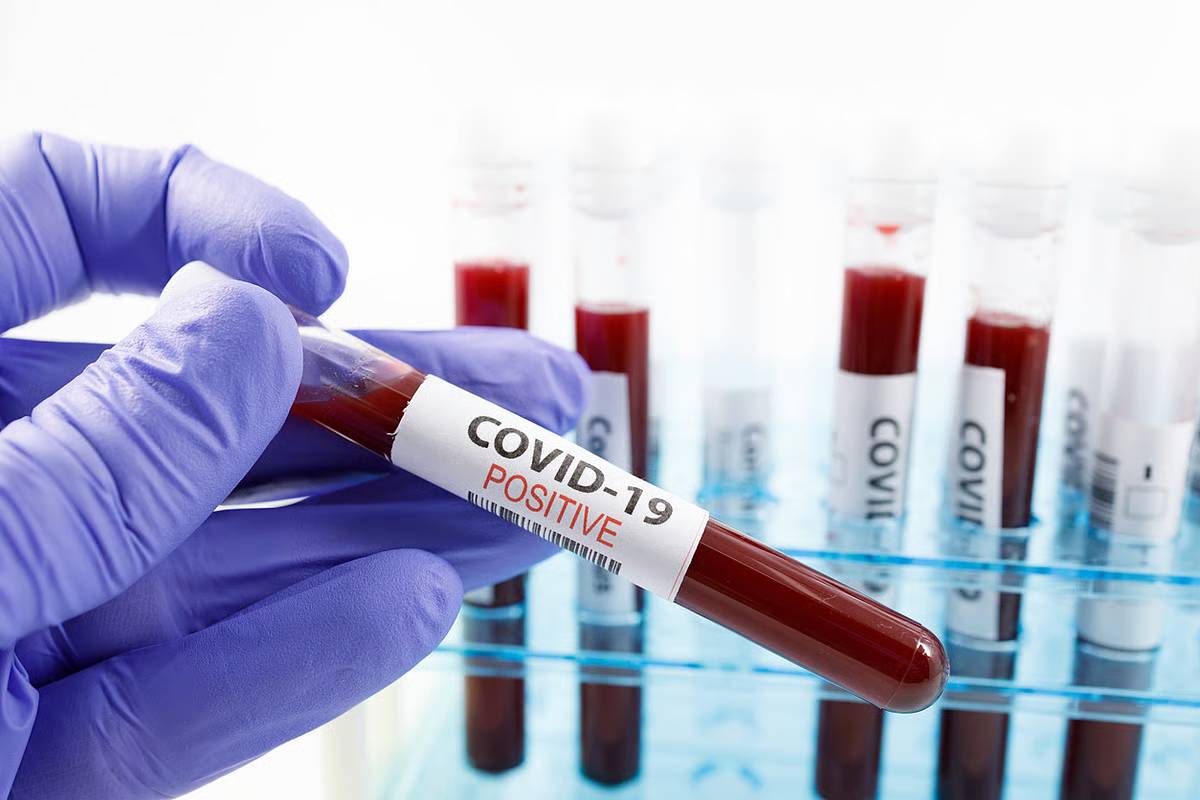 கோவிட் தொற்றுக்கு இருவர் பலி... பரபரப்பாகும் இந்திய மாநிலம் | 2 Death As Covid Resurfaces In Andhra Pradesh கோவிட் தொற்றுக்கு இருவர் பலி... பரபரப்பாகும் இந்திய மாநிலம் | 2 Death As Covid Resurfaces In Andhra Pradesh