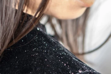 பொடுகு தொல்லைக்கு நிரந்தர தீர்வு! அருமையான டிப்ஸ் இதோ