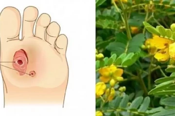 சர்க்கரை நோயாளிகளே! காலில் வரும் புண்களை வேகமாக குணமாக்க வேண்டுமா? இதோ ஓர் அற்புத மருந்து