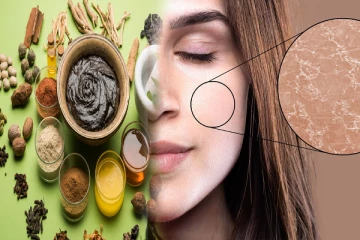 வறண்ட சருமத்தை அழகுபடுத்தணுமா?அப்போ இந்த ஆயுள்வேத மூலிகைகள் ட்ரை பண்ணுங்க