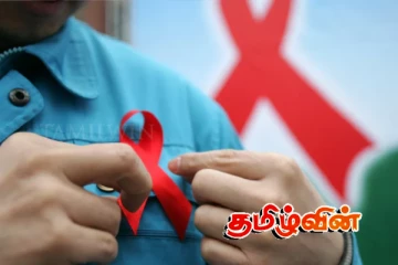 கடுமையான பொது சுகாதார நெருக்கடியில் இலங்கை.. விடுக்கப்படும் எச்சரிக்கை