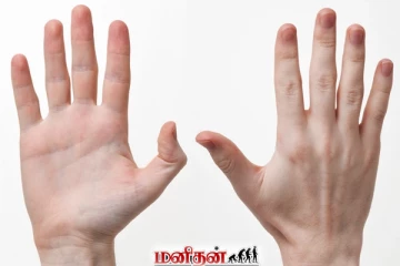 கைகளை வைத்தே உங்க ஆரோக்கியத்தை தெரிஞ்சிக்கலாம்... எப்படினு தெரியுமா?