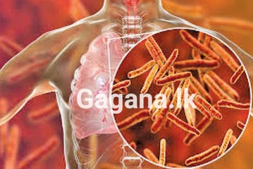 මෙරට තුළ රෝගීන් පිරිසකගේ ඉහළ යෑමක් - දරුවන් ගැනත් සැලකිලිමත්වන්න..