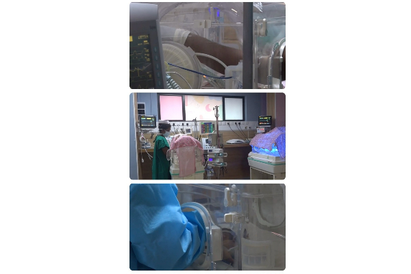 කාසල් රෝහලෙන් සය නිවුන් දරු උපතක්.(VIDEO/PHOTO) | A Birth Of Six Twins