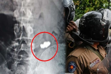 தங்கத்தை விழுங்கி பொலிஸாரை குழப்பத்தில் ஆழ்த்திய கொள்ளையன்