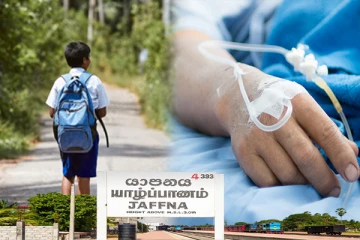 யாழில் தாக்கப்பட்ட மாணவன்! சிகிச்சைக்காக வைத்தியசாலையில் அனுமதி