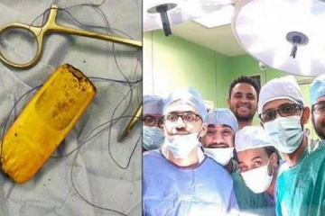 6 மாதமாக  வயிற்றில் செல்போனுடன்  உலா வந்த நபர்! மருத்துவர்கள் அதிர்ச்சி