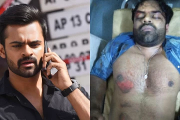 விபத்தில் சிக்கிய பிரபல தெலுங்கு நடிகர்! வெளியான அதிர்ச்சி தகவல்...