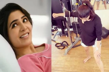 நடிகை சமந்தா உடல்நிலை மோசம்? இதை செய்யவில்லை என்றால் உயிருக்கு ஆபத்து..!