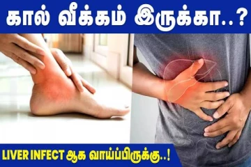 கால் வீக்கம் இருக்கா? இந்த நோயின் அறிகுறியாகவும் இருக்கலாம்...!