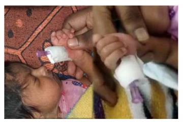 செவிலியரின் அலட்சியம்... குழந்தையின் கட்டைவிரல் வெட்டப்பட்ட கொடுமை