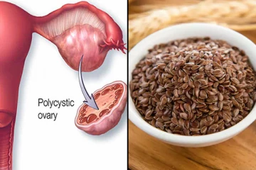 பெண்களே பிசிஓஎஸ் பிரச்சினையால் பெரும் அவதியா? இதை சரி செய்ய இவற்றை செய்தாலே போதும்