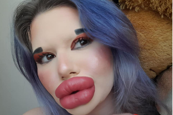 உலகின் மிகப்பெரிய உதடு கொண்ட பெண்; சாதனையை வெல்வாரா! | The Woman Biggest Lips World Beat The Record உலகின் மிகப்பெரிய உதடு கொண்ட பெண்; சாதனையை வெல்வாரா! | The Woman Biggest Lips World Beat The Record