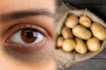 ஒரே வாரத்தில் கருவளையம் நீங்க உதவும் உருளைக்கிழங்கு: எப்படி பயன்படுத்துவது?