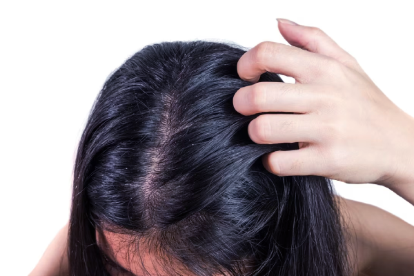 இனி ரசாயன முடி சாயம் வேண்டாம் - இந்த 4 பொருளில் 30 நிமிடத்தில் முடியை கருப்பாக்கலாம் | How To Make Natural Hair Dye Home Remedy