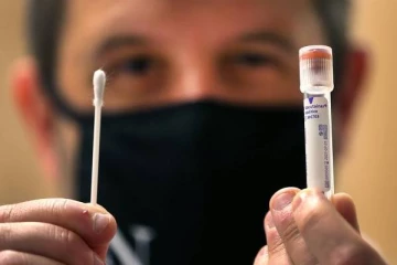 நெருப்புடன் விளையாடும் அமெரிக்க ஆய்வகம்... 80% பேர்கள் மரணமடையலாம்: வெடித்த சர்ச்சை