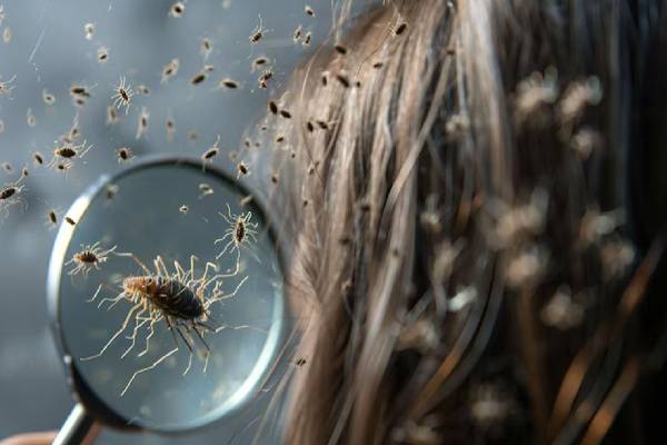 நம்ம தலையில் எப்படி பேன் வருதுன்னு தெரியுமா? வியக்க வைக்கும் உண்மைகள்! | Do You Know How Lice Get On Our Heads