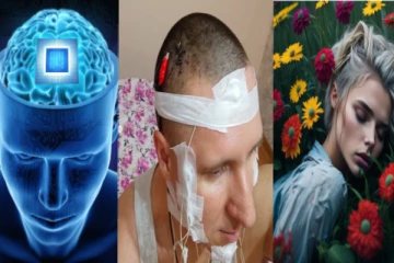 கனவை கட்டுப்படுத்த ட்ரில்லரால் மூளையை துளையிட்டு சிப்பை பொருத்திய விநோத மனிதர் - அதிர்ச்சி சம்பவம்!