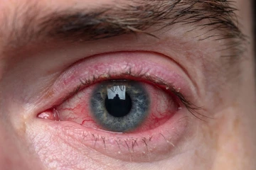 தமிழகத்தை அச்சுறுத்தும் கொடிய நோய்! இந்த அறிகுறிகள் இருந்தால் எச்சரிக்கையாக இருங்க