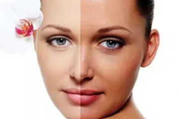 வெயிலால் முகத்தில் ஏற்பட்ட கருமையை போக்கனுமா? இதோ சில வீட்டு குறிப்புகள்!