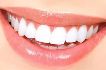 பளபளவென பற்கள் ஜொலிக்க வேண்டுமா? இதோ ஒரு வழி