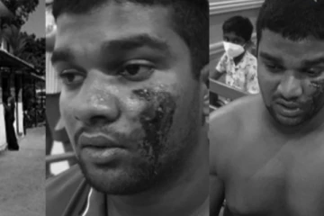 பொலிஸாரின் அத்துமீறிய செயற்பாடு; தாக்குதலுக்குள்ளான சட்டக்கல்லூரி மாணவன் தொடர்பில் சட்டமா அதிபருக்கு முக்கிய கடிதம்!