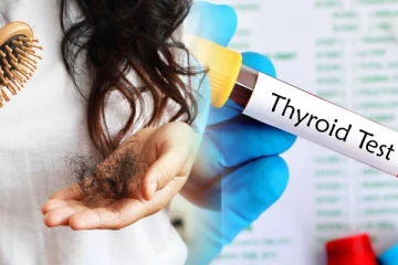 அதிகமா முடி கொட்டுதா? அப்போ தைராய்டு டெஸ்ட் எடுத்து பாருங்க
