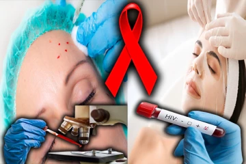 இரத்தத்தால் பிரபலமான வேம்பையர் பேஷியல்: எச்ஐவியை பரப்பும் கொடூரம்