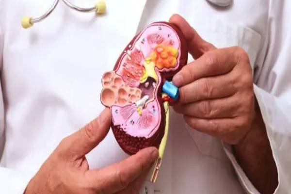 சிறுநீரகத்தில் மட்டுமல்ல இந்த 4 இடத்திலும் கற்கள் உருவாகும் - எங்கு தெரியுமா? | Stones Only In The Kidneys Also In These 4 Places சிறுநீரகத்தில் மட்டுமல்ல இந்த 4 இடத்திலும் கற்கள் உருவாகும் - எங்கு தெரியுமா? | Stones Only In The Kidneys Also In These 4 Places