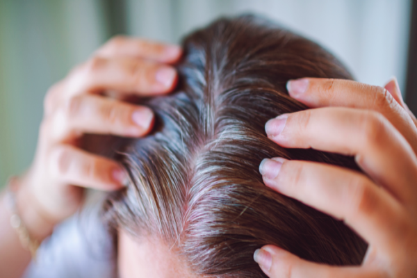 இளம் வயது நரைமுடி - தேங்காய் எண்ணெயில் இந்த ஒரு பொருள் கலந்து பூசுங்க | Grey Hair At A Young Age Mix With Coconut Oil