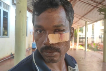 புதுக்குடியிருப்பில் டிப்பர் சாரதி மீது இராணுவ புலனாய்வாளர்கள் கொடூர தாக்குதல்