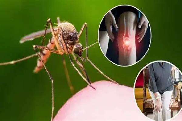 மாத்தறை மாவட்ட மக்களுக்கு விடுக்கப்பட்டுள்ள அவசர எச்சரிக்கை | Severe Outbreak Of Chikungunya In Matara மாத்தறை மாவட்ட மக்களுக்கு விடுக்கப்பட்டுள்ள அவசர எச்சரிக்கை | Severe Outbreak Of Chikungunya In Matara