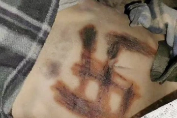 உக்ரைனில் கொடூரமாக கொல்லப்பட்ட சிறுமிகள் உடலில் ஸ்வஸ்திகா முத்திரை