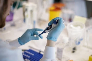 முதன் முறையாக மனிதர்களிடம் கண்டுப்பிடிக்கப்பட்ட கொடிய நோயை உருவாக்கும் வைரஸ்!