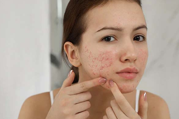 மாம்பழம் சாப்பிடும் போது செய்யக்கூடாத தவறுகள்! பயங்கர பக்கவிளைவு ஏற்படுமாம் | Mango Benefits In Tamil