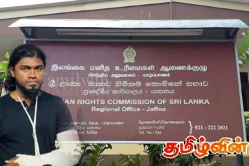 இளைஞனின் கையை முறித்த விவகாரம்: பொலிஸாரை மனித உரிமைகள் ஆணைக்குழு அழைப்பு