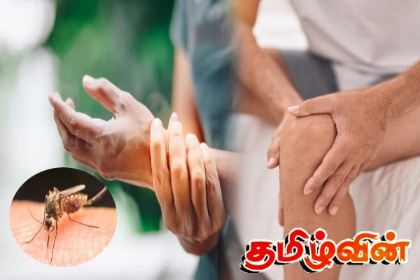 சிக்குன்குனியா காய்ச்சலால் பாதிக்கப்பட்டவர்களுக்கு ஏற்படும் ஆபத்து | Chikungunya Can Cause Long Term Arthritis