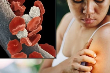 இரத்த புற்றுநோயின் ஆபத்தை பாதியாக குறைக்கனுமா? அப்போ  இந்த உணவுகளை தினமும் சாப்பிடுங்க