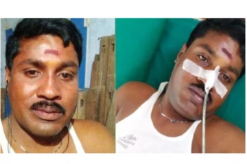 ஜி.பி முத்துவை சரமாரியாக பிளேடில் வெட்டிய சகோதரர் - அதிர்ச்சியில் ரசிகர்கள்..!