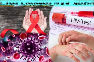 HIV symptoms: உயிரை பறிக்கும் HIV... ஆண்களே இந்த அறிகுறிகளை அலட்சியப்படுத்தாதீங்க