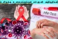 HIV symptoms: உயிரை பறிக்கும் HIV... ஆண்களே இந்த அறிகுறிகளை அலட்சியப்படுத்தாதீங்க
