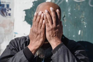 வழுக்கைத்தலை கேலி; பெண்களின் மார்பகத்தை கேலி செய்வதற்கு சமம் - நீதிமன்றம்