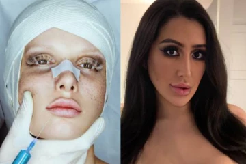 15 அறுவை சிகிச்சை! ஆளே அடையாளம் தெரியாமல் மாறிப்போன பெண் கூறிய விடயம்