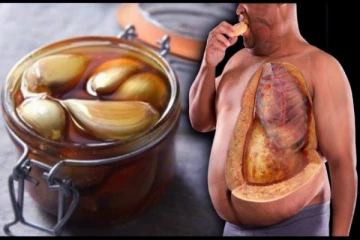 தினம் 3 பல் வறுத்த பூண்டு கொலஸ்ட்ராலுக்கு முட்டுக்கட்டை போடுமா? மருத்துவ விளக்கம்