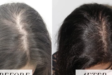 முடி அடர்த்தியாக நீளமாக வளர! வீட்டிலேயே தயார் செய்யலாம்