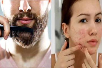 தாடியுள்ள பார்ட்னர் இருந்தால் அப்போ கண்டிப்பாக இந்த நோய் உங்களுக்கு இருக்கும்! உண்மையை தெரிஞ்சுக்கோங்க..