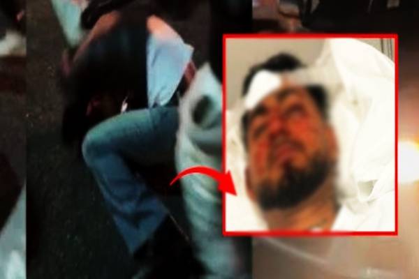அவுஸ்திரேலியாவில் இந்திய மாணவன் மீது சரமாரி தாக்குதல் | Racist Attack On Indian Student In Australia