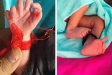 26 விரல்களுடன் பிறந்த அதிசய குழந்தை