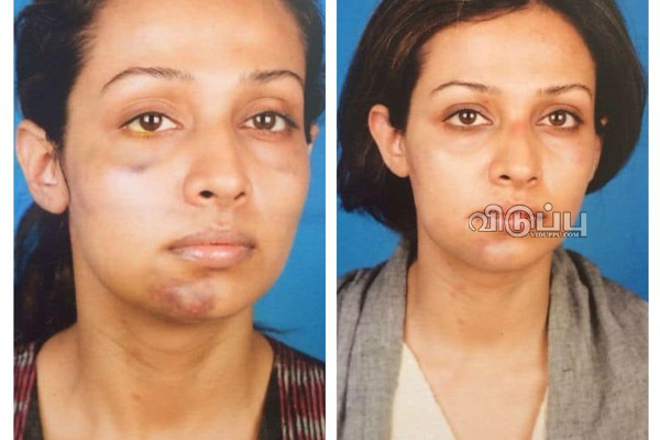 44 வயது நடிகையின் அந்தரங்க உறுப்பை தாக்கிய தயாரிப்பாளர்!! உண்மையை உடைத்த பயில்வான் | Private Parts Flora Saini Recalls Her Abusive