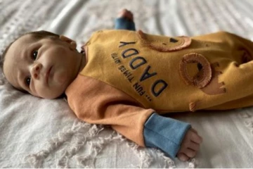 பிரித்தானியாவில் வித்தியாசமான நோயால் பாதிக்கப்பட்ட பச்சிளங் குழந்தை! தாய் எடுத்த முடிவு